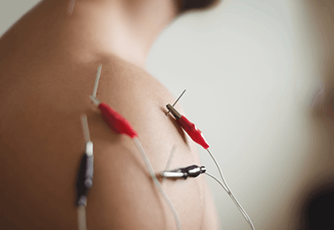 TENS Therapy 1