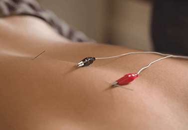 TENS Therapy 2